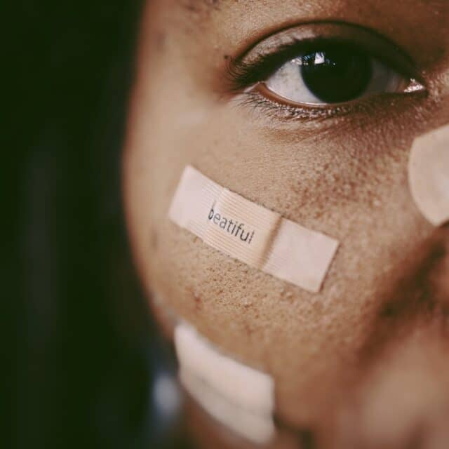 EMDR Therapy: A lady stares into the camera covered in three band-aids, one of which reads "beautiful"